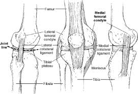 In addition to the already documented associations between shape and pathology, a specific knee morphotype, characterized by a smaller medial femoral condyle (smc). Knee Orthopaedic Tests Musculoskeletal Key