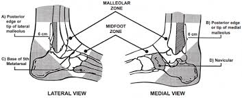 Et, health officials announced thursday morning. Ottawa Ankle Rules Physiopedia