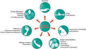 Cdc's arthritis program examines comorbidities in two ways Comorbidities And The Impact Of Atopic Dermatitis Sciencedirect