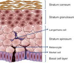 In this case, accumulation of the desquamated epidermis and cerumen occurs, what can lead to the formation of cholesteatoma. Epidermis An Overview Sciencedirect Topics