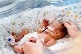 Image result for Preterm Infant