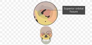 The superior orbital fissure is travels from the apex of the orbit laterally, anteriorly, and superiorly. Superior Orbital Fissure Sphenoid Bone Inferior Orbital Fissure Png 770x406px Superior Orbital Fissure Anatomy Atlas Bone