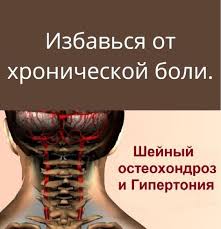 6 типов ожирения и как справиться с каждым из них Epingle Sur Sante