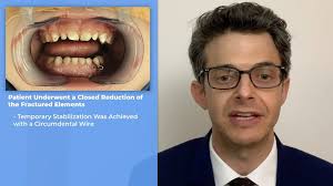 The #FacetheCase results are in and you chose:, Option B