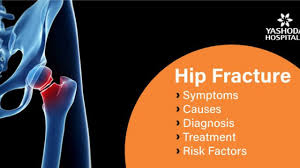 In rare cases, these can also. How To Treat Hip Fractures