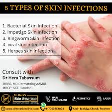 Image result for Skin Infection