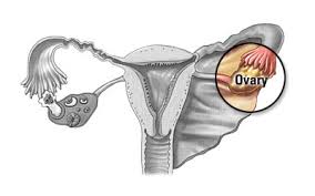 The wikimedia human body diagrams is a collection of images whose main purpose is to provide a way of explaining medical conditions and other phenomena. Vaginas Cervixes Uteruses And More Island Sexual Health