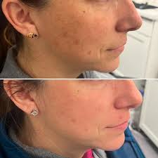 Julie Jackson McDonald (@the_wellnesswitch_cnm) • Instagram photos and  videos