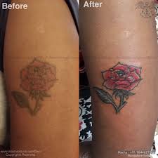 If your tattoo needs touch up work, it is very important to wait until after the first tattoo is completely healed. Rose Touchup Rad Tattoo Done By Suresh Machu From Machu Tattoo Studio Best Realistic Tattoo Artist Tattoo Studio Best Tattoo Shops Tattoos