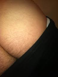 Laser hair removal is a procedure where a specific beam of light bypasses the epidermis and targets the follicle, disabling the reproductive cycle of the hair without hurting the skin, says. Laser Buttcheek Hair Laser Hair Removal Hairtell Hair Removal Forum By Andrea James