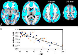 Providing independent and trusted software supply, services, management and advice for organisations seeking development, technical and. Age Related Changes In Grey And White Matter Structure Throughout Adulthood Sciencedirect