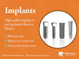 Dental Implants In Tijuana Bc Mexico Dental Tourism Dental Implants Dental Crowns