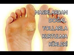 Ayaklar Vucudumuzun Onemli Organlarindan Biri Ama Saglikli Olmasina Dikkat Verdigimiz Organlardan Degil Ayaklarda Gorulen En Dogal Dogal Cilt Dogal Sac Bakimi