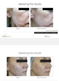 Dr. Aymen Atallah MD