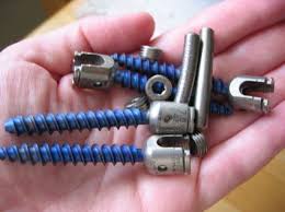 Pin On Scoliosis Strong