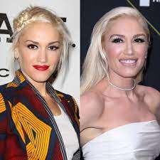 Shelton is reportedly quite unhappy with stefani's changing looks and love of plastic surgery. Gwen Stefani Had Multiple Plastic Surgery Procedures Experts Believe