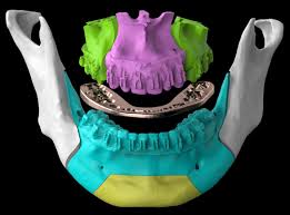 Wow, i never noticed, but you have a crooked jaw! oh…uhm, okay? i mean, and it's not that insignificant. Nucohs
