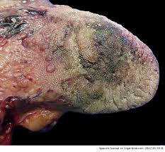 Examination of the gunshot wound can help determine many factors involved in the shooting, including the distance of the shooter from the victim. Deaths By Firearm And Intraoral Gunshot Medicolegal Etiology Spanish Journal Of Legal Medicine