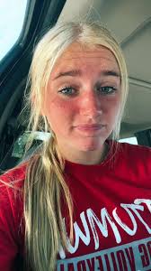 finally got them off 🥳