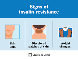 Image result for Insulin