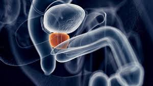 Prostata 5 Symptome Fur Eine Kranke Prostata