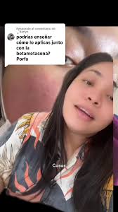 Betametasona Inyectable Como Se Aplica