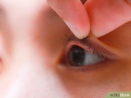 If the object is on an eyelid, try to gently flush it out with water or eye drops. 3 Ways To Flip Eyelids Inside Out Wikihow