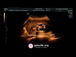 16 haftalik 3 5 aylik erkek bebek ultrason goruntuleri bebegin kilosu ve boyu ne kadardir youtube