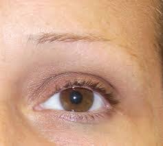 And, of course, there is a whole world of cosmetics and great new brow treatments that can help. Eyebrow Hair Loss Causes And Remedies Eyebrow Hair Loss