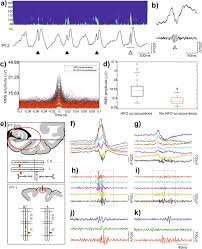 The role of superficial and deep layers in the generation of high frequency  oscillations and interictal epileptiform discharges in the human cortex