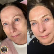 Beauty Concept By Kay Holtz