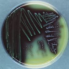 It was named innocua (innocuous) because as opposed to pathogenic listeria monocytogenes, l. Oxford Agar
