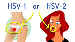 However, a variety of symptoms may appear in the mouth or. Hsv 1 Vs Hsv 2 Separating Facts From Myths Luminance Red