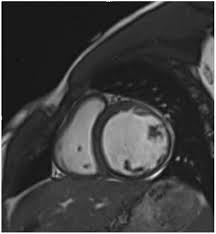 2024 Midwest Clinical & Translational Research Meeting Abstract Supplement,  2024