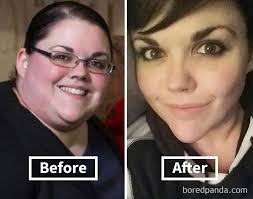 128 Surprising Photos of Face Fat Loss Before and After Weight Loss