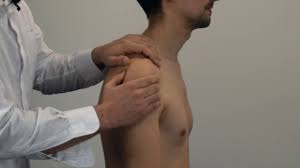 Image result for Shoulder Subluxation