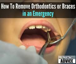 The simplest way to safely trim your fingernails without nail clippers is to use your eye teeth, fingers, and a rough surface. How To Remove Orthodontics Or Braces In An Emergency Preparedness Advice