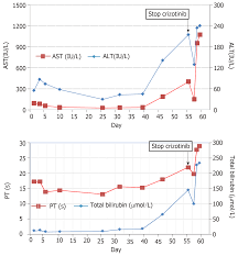 Crizotinib Induced Acute Fatal Liver Failure In An Asian Alk