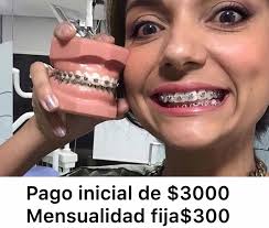 GRAN PROMOCION* 50% Del Mes👈 ORTODONCIA (BRACKETS)PAGO INICIAL $3000  dividida en dos pagos 1500 👉👉Mensualidad de $300👈👈 Fija👈 RESINA 3M DE  LA MAS ALTA CALIDAD$200 LIMPIEZA ULTRASONICA $200 AGENDA TU CITA WhatsApp  2221267651
