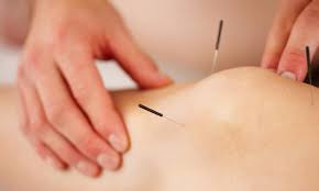 We did not find results for: Arthrose Im Knie Akupunktur Die 10 Besten Tipps Bei Arthrose Im Knie Praxisvita De