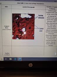 It can be found under the periosteum and in the diaphyses of long bones, where it provides support and protection. Bone And Cartilage Descriptions And Functions Of Chegg Com