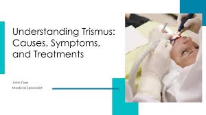 Image result for Trismus