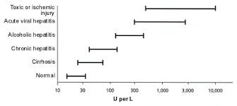 special considerations in interpreting liver function tests