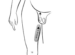 Image result for Cremasteric Reflex