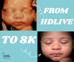 Turn your ultrasound into a hyper realistic photo with 8K!