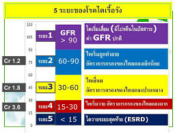 ไตเสื่อมระยะ4 ไตเสื่อมระยะ5 ไตวายระยะสุดท้าย developed by think up themes ltd. à¹„à¸•à¹€à¸ª à¸­à¸¡ à¹„à¸•à¸§à¸²à¸¢ à¹€à¸› à¸™à¸­à¸²à¸à¸²à¸£à¸— à¸—à¸³à¹ƒà¸« à¸ª à¸‚à¸ à¸²à¸žà¸œ à¸› à¸§à¸¢à¸šà¸­à¸šà¸šà¸²à¸‡