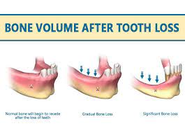 Pin On Oral Surgery