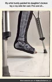 Funsubstance Funny Pics Memes And Trending Stories Broken Leg Leg Cast It Cast