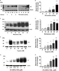 King barry c thomas — rescue you 03:45. Frontiers Par2 Activation On Human Kidney Tubular Epithelial Cells Induces Tissue Factor Synthesis That Enhances Blood Clotting Physiology