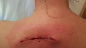 In the united states, it's estimated that doctors diagnose over 100,000 new skin cancer cases each year. Organization Profile